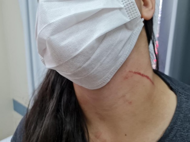 Homem é preso após ferir mão e pescoço da esposa em Rio dos Cedros