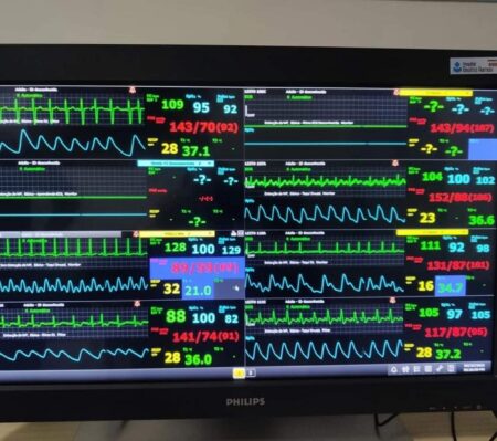 Hospital de Indaial adquire novo equipamento para monitorização de pacientes críticos da UTI