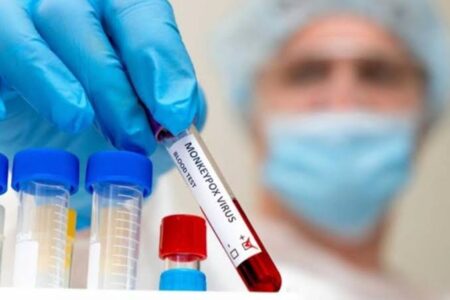 Primeiro caso de varíola dos macacos em Jaraguá do Sul é confirmado