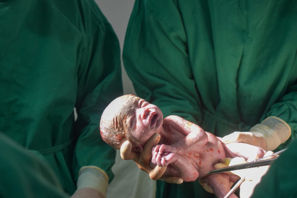 Hospital de Blumenau registra caso raro de nascimento de trigêmeos