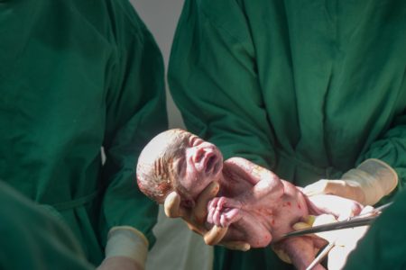 Hospital de Blumenau registra caso raro de nascimento de trigêmeos