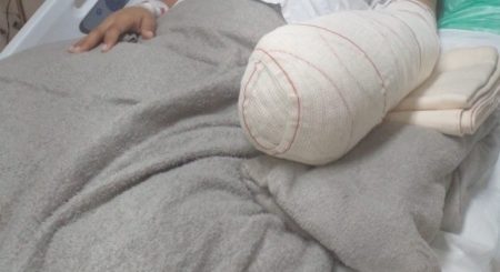 Mulher tem a mão amputada após parto no Rio de Janeiro