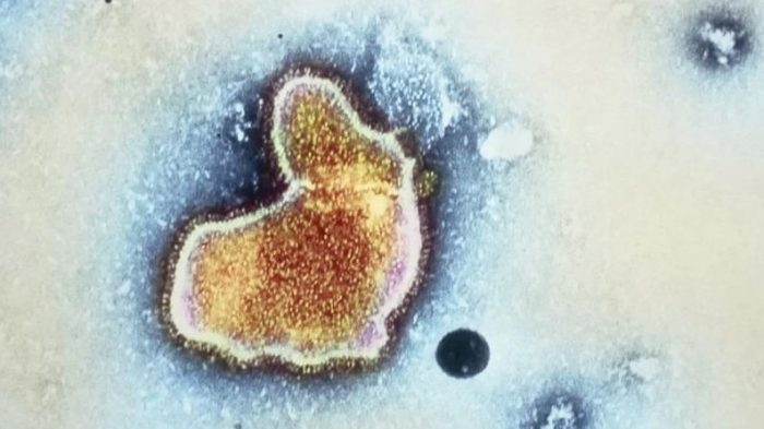 EUA aprova primeira vacina do mundo contra vírus que provoca bronquiolite