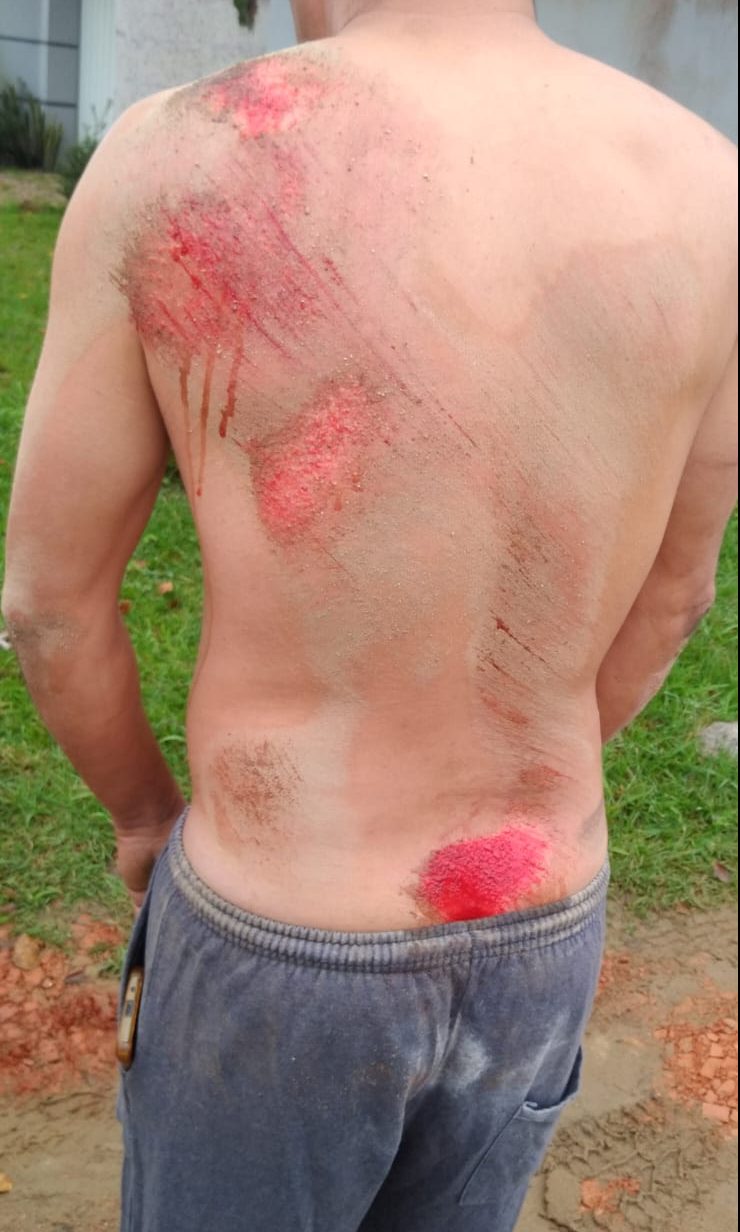 Após ação trabalhista, homem é agredido e atropelado por ex-patrão em Timbó