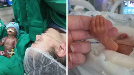 O milagre do bebê de apenas 800 gramas que lutou pela vida em Blumenau