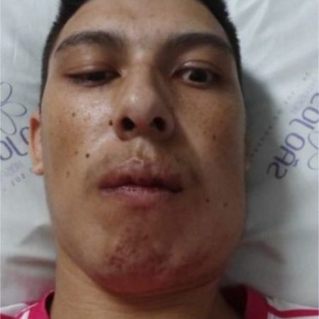 Jovem agredido violentamente durante jogo de futebol morre em Guaramirim