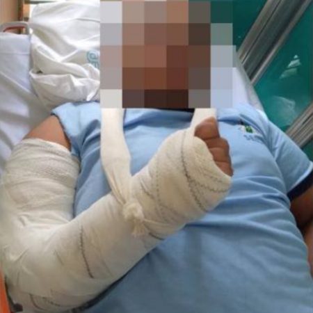 Policial militar quebra braço de aluno autista em escola