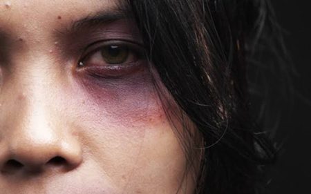 Mulher fica com lesões no rosto após receber socos do companheiro em Indaial 