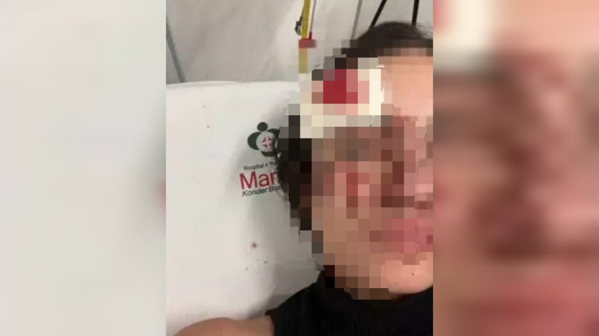 Em Itajaí, estudante de 21 anos é brutalmente agredida por homem ao sair de universidade