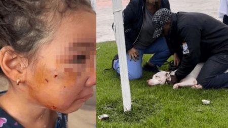 Em Navegantes, dono de pitbull que atacou criança de 3 anos é preso 