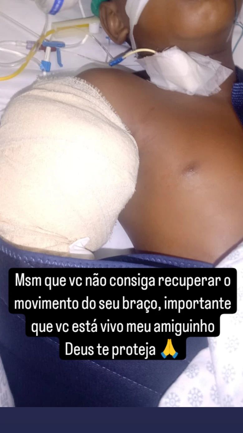 Criança tem braço arrancado em acidente; motoboy salva menino e volta para resgatar o braço