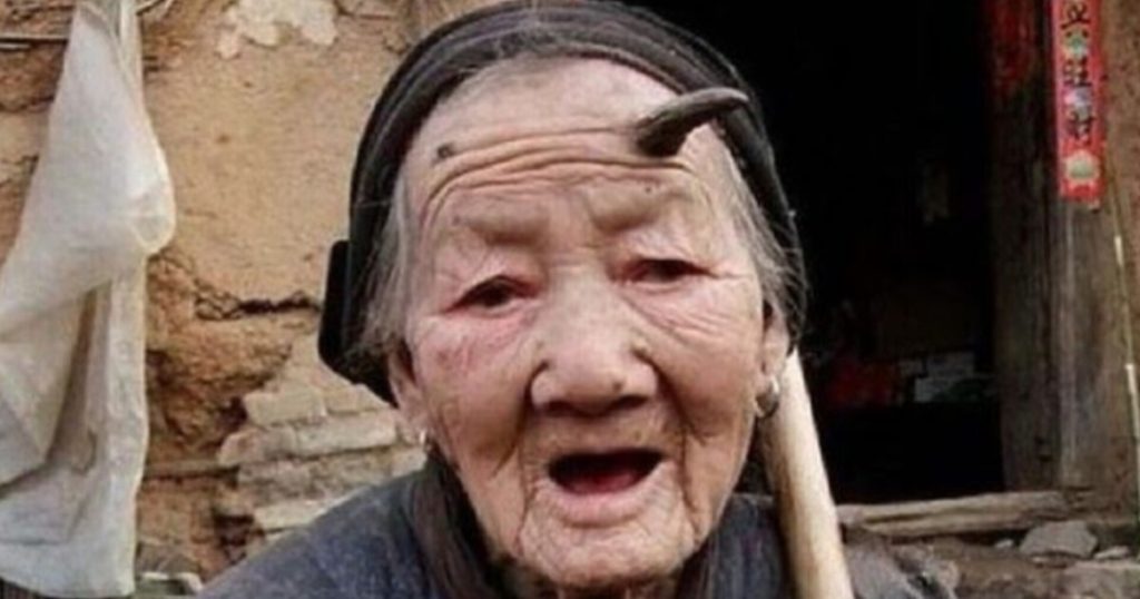 Chinesa de 107 anos choca a internet ao exibir chifre de 10 cm