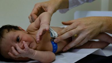 SC torna obrigatório o Teste do Olhinho para recém-nascidos em todos os hospitais