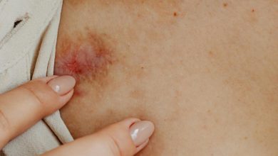 Mulher é agredida pela companheira e chega na delegacia com diversas lesões em Jaraguá do Sul