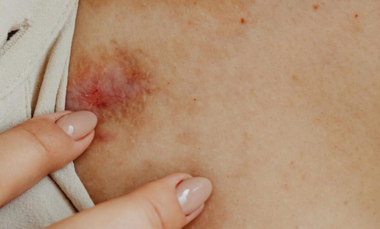 Mulher é agredida pela companheira e chega na delegacia com diversas lesões em Jaraguá do Sul