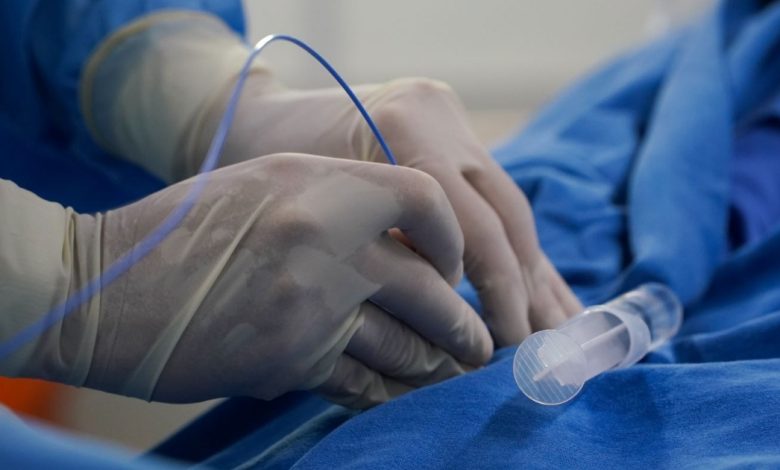 Laqueaduras e vasectomias no SUs em SC tem recorde em 2024