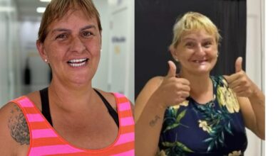 Fim do mistério! Conheça o novo sorriso de Mery ❤️