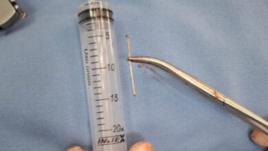 Adolescente sobrevive após disparar prego no próprio coração em SC