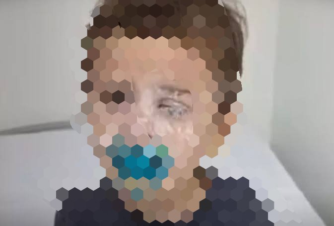 Bebê é levado ao hospital após colar o olho com Super Bonder em Santa Catarina