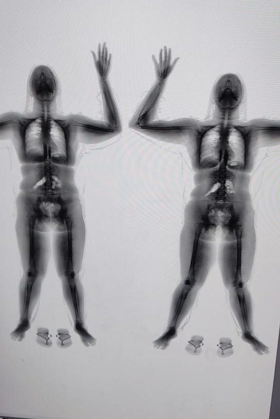 Mulher é flagrada tentando levar drogas para dentro da Penitenciária de Blumenau