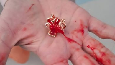 Corrida contra o tempo: PM ajuda a salvar menina de 2 anos engasgada em Caçador