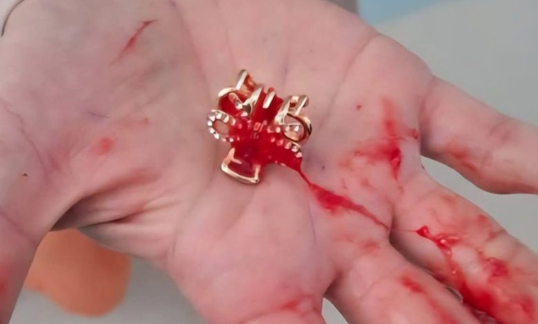 Corrida contra o tempo: PM ajuda a salvar menina de 2 anos engasgada em Caçador