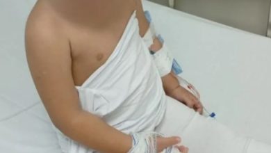 Menina de dois anos é queimada pela madrasta dentro de casa em Itajaí