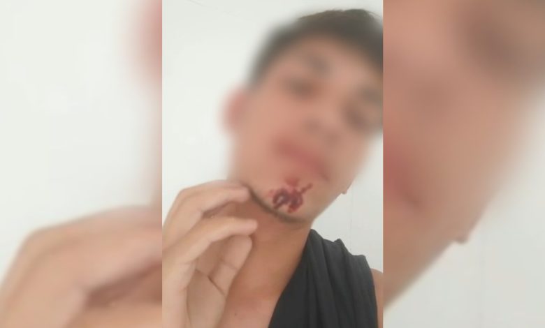 Fiscal é demitido após agredir adolescente vendedor de morangos em BC