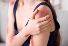 Mulher ferida é levada ao hospital após ser agredida pelo companheiro durante discussão em Pomerode