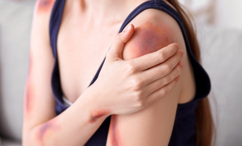 Mulher ferida é levada ao hospital após ser agredida pelo companheiro durante discussão em Pomerode