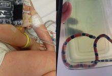 Cobra-coral é confundida com minhoca e menina de 4 anos sofre picada em SC