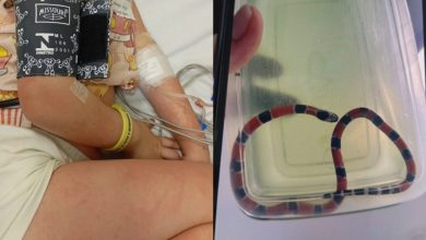 Cobra-coral é confundida com minhoca e menina de 4 anos sofre picada em SC