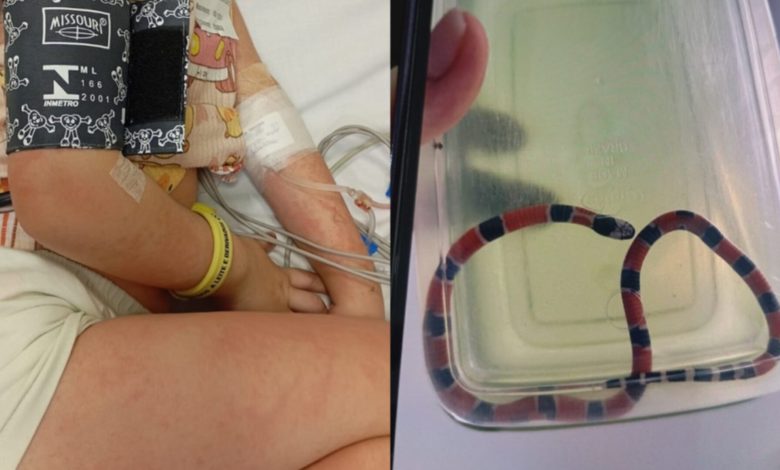 Cobra-coral é confundida com minhoca e menina de 4 anos sofre picada em SC