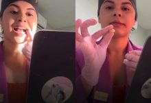 Dentista impressiona a internet ao extrair o próprio siso em consultório