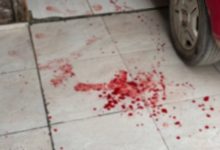 Violento ataque com facão deixa vítima com múltiplos ferimentos em Ilhota