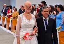 Catarinense que enfrentou 73 cânceres de pele se casa com homem que conheceu durante tratamento