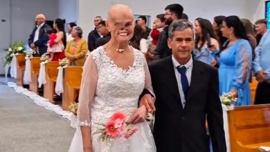 Catarinense que enfrentou 73 cânceres de pele se casa com homem que conheceu durante tratamento