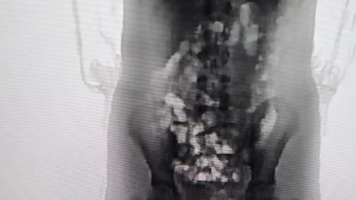 Adolescente de 13 anos é flagrada com 32 porções de skank no corpo ao entrar em presídio de SC