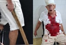 Idoso leva 21 pontos após ataque com taco de beisebol e suspeito debocha em SC
