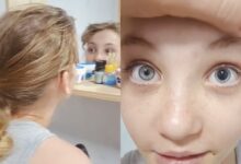 Menina de 9 anos cheira flor tóxica e vai parar no hospital após alteração nos olhos