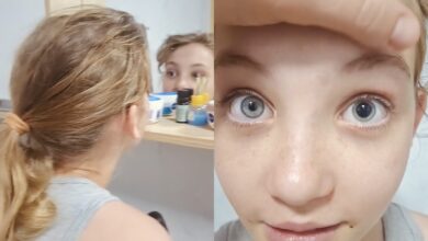 Menina de 9 anos cheira flor tóxica e vai parar no hospital após alteração nos olhos