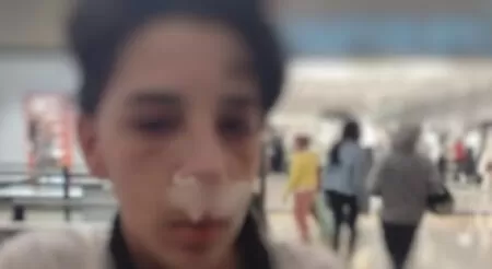 Adolescente tem o nariz quebrado por segurança de Shopping em São Paulo